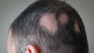 near hair treatment in anantapur