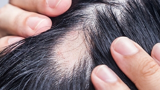 best hair treatment in anantapur