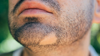 hair fall control in anantapur