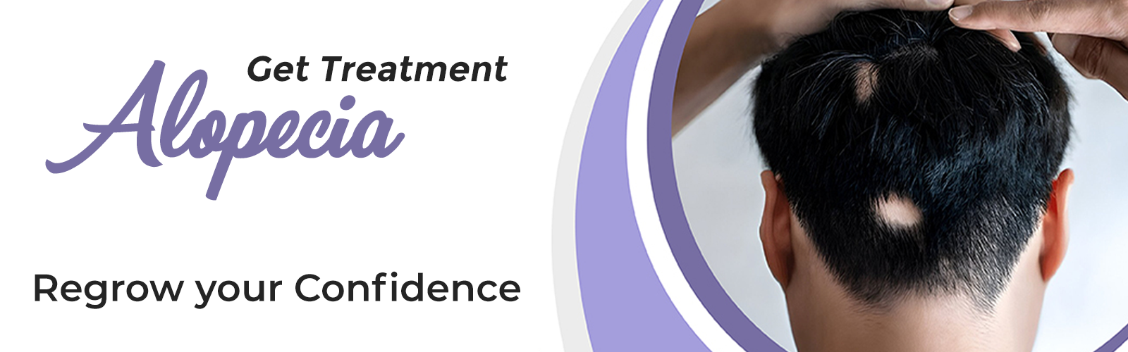 Alopecia Treatment in taha