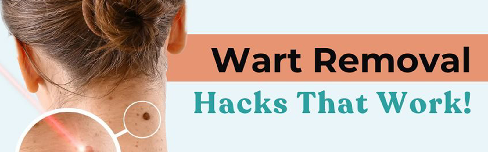 Alopecia Treatment 2