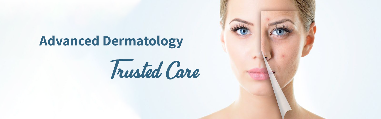 Alopecia Treatment 3