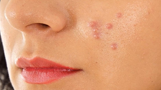 top dermatalogy hospitals