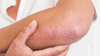 taha dematalogy hospital