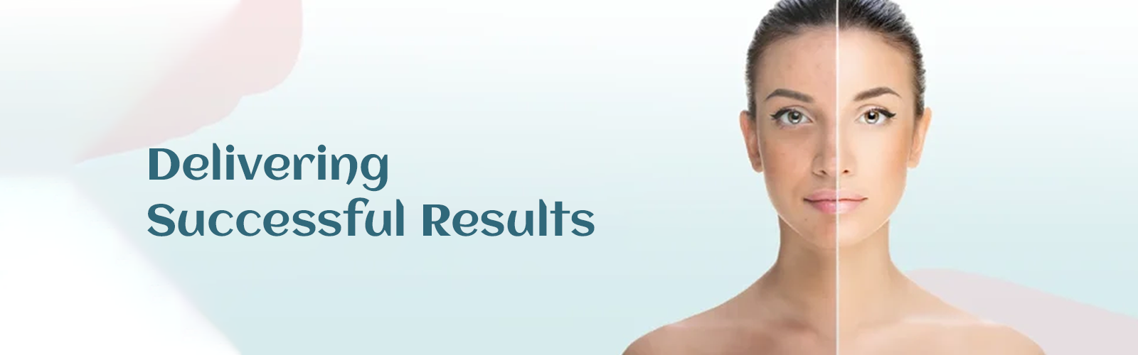 Alopecia Treatment 2