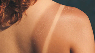 best tan removing in anantapur